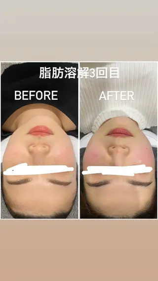 毛穴洗浄・痩身・脱毛 /アルカンジュのエステ・リラクイメージ