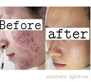 都度払い肌改善専門店 店長二上文香のエステ・リラクイメージ