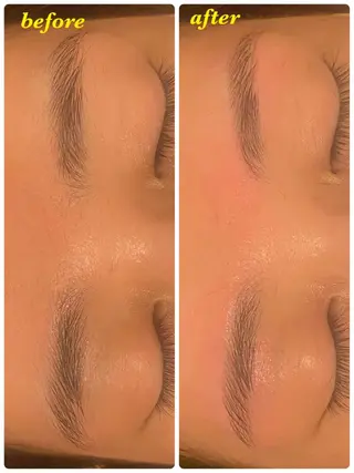 アイブロウ ハーブピーリング/韓国肌管理/フェイシャル/毛穴洗浄/眉毛/顔脱毛【糸脱毛専門】rev所属・ハーブピーリング🌹 毛穴洗浄❤️眉waxのエステ・リラクイメージ