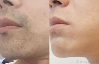 メンズ プライベートサロンBRAG所属・プライベートサロン BRAG🏠男女OKのエステ・リラクイメージ