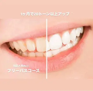 ホワイトニングショップ伊丹店所属・ホワイトニング ショップ伊丹店のその他イメージ