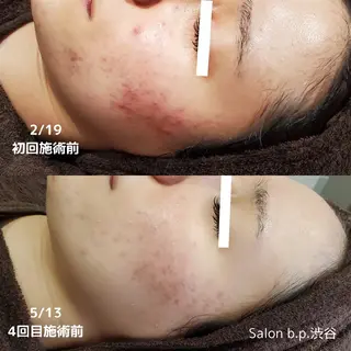 Salon b.p. 渋谷のエステ・リラクイメージ