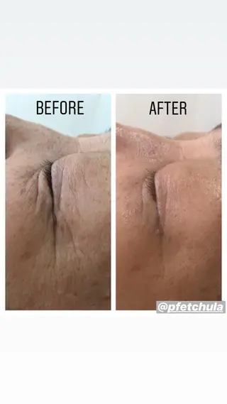 KOHAKU.所属・Nana Kikutaのエステ・リラクイメージ