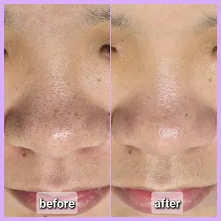 facial salon Lily所属・salon Lilyのエステ・リラクイメージ