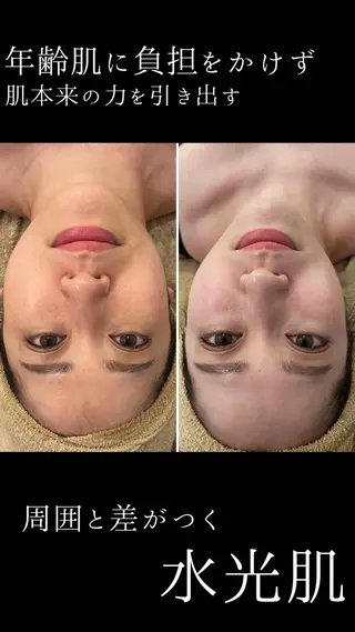 小顔・たるみ専門看護師クリニカルサロンTROIS所属・クリニカルサロン トロワのエステ・リラクイメージ