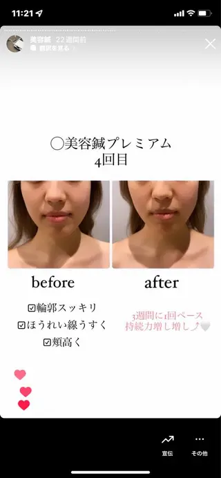 種市 貴子のその他イメージ