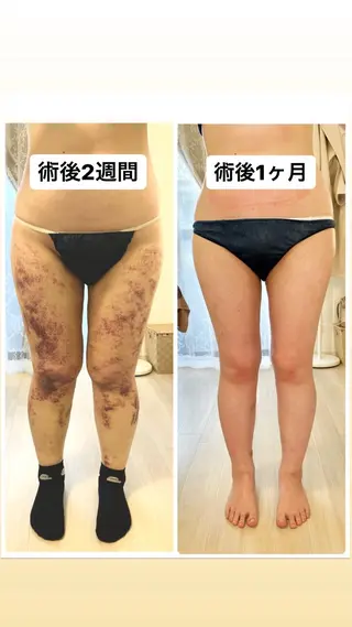 メディカル インディバサロン同心のエステ・リラクイメージ