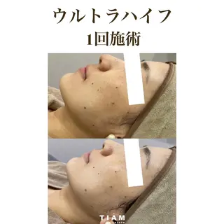 美肌サロンTIAM by tetoteのエステ・リラクイメージ