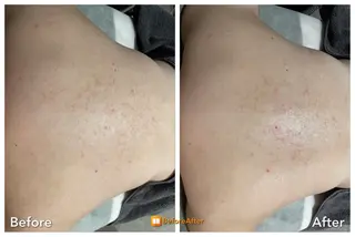 Meupニキビ専門店 背中/ハーブ/肌管理のその他イメージ