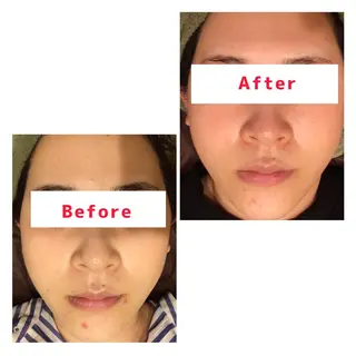 ハーブピーリング専門 muro.のエステ・リラクイメージ