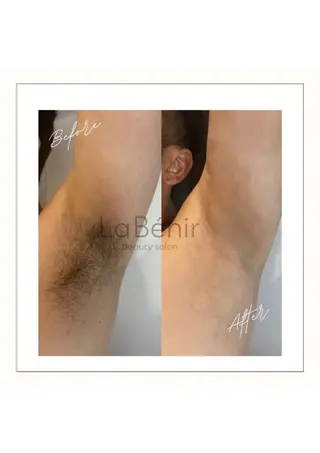 脱毛/美肌【皮膚科看 護師経営】ラベニールのエステ・リラクイメージ