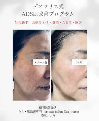 private salon Dea_maris シュガーリング&パーソナルボディケア所属・シミ改善・韓国肌管理 ボディメイク痩身のその他イメージ