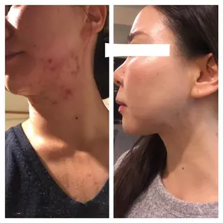 Leading Ladiesのエステ・リラクイメージ