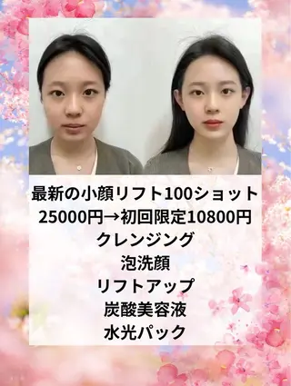 マツエク・マツパ aliaハイフ&水光ジェットサロン所属・aliaハーブ水光店 エステティシャン募集のエステ・リラクイメージ