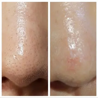 久保 まおのエステ・リラクイメージ