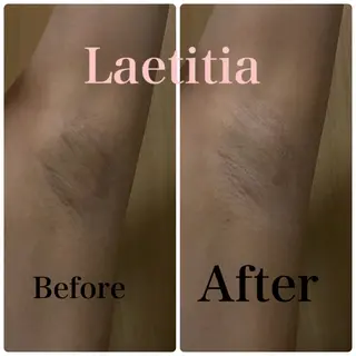 レティティア【Laetitia】所属・レティティア秋葉原店 Yoshizawaのエステ・リラクイメージ