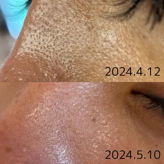 Del'm豊橋所属・豊橋De'Im 安部のエステ・リラクイメージ