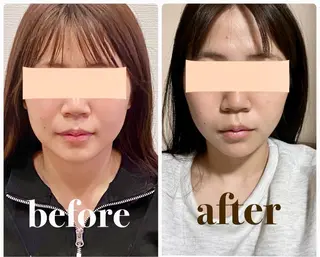 小顔矯正専門店Cream所属・菅野 もえのエステ・リラクイメージ