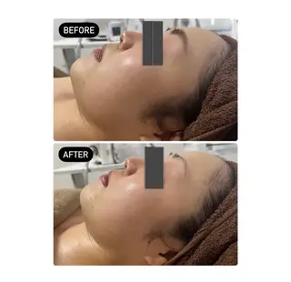 IBERIA心斎橋店 🌼凝り小顔美肌痩身のエステ・リラクイメージ