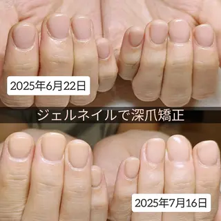 ネイル 深爪矯正/爪育成ケア manie nailのネイルデザイン