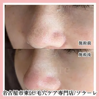  毛穴洗浄・まつ毛 の専門店 ソラーレのエステ・リラクイメージ