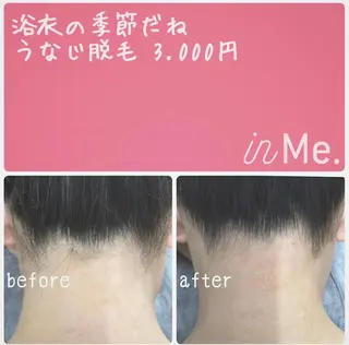 in Me.(インミー)所属・◆つど払い脱毛◆ in Me.インミーのエステ・リラクイメージ