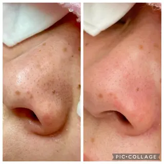 フェイシャルエステFOUATONS*所属・フェイシャルエステ ふわっとんのエステ・リラクイメージ