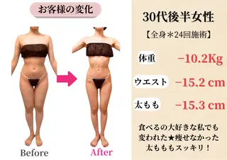 Belle White所属・本格痩身＊肌質改善＊ BelleWhiteのエステ・リラクイメージ