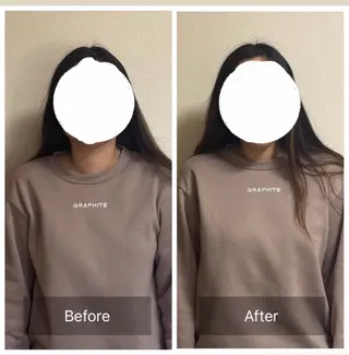 脳休ヘッド ストレッチのその他イメージ