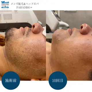 メンズ 【パラディソ＋】後藤 まりやの眉毛・アイブロウイメージ