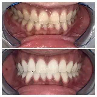 ヘアアレンジ ネイル マツエク・マツパ メンズ カラー パーマ アイブロウ キッズ ショート ライトビューティー 銀座店のエステ・リラクイメージ