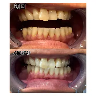 セルフホワイトニング　アデル所属・戸嶋 菫のエステ・リラクイメージ