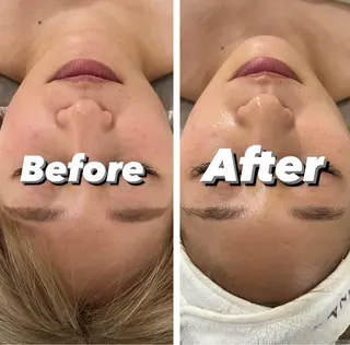 脱毛＆Beauty salon IILA所属・垢抜けお手伝い💖 Sakuraの眉毛・アイブロウイメージ