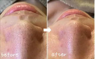 美肌専門サロン かれんのエステ・リラクイメージ