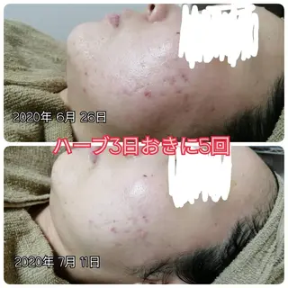 未病ケアサロン　EMINY所属・未病ケアサロン EMINY☺︎勝俣のエステ・リラクイメージ