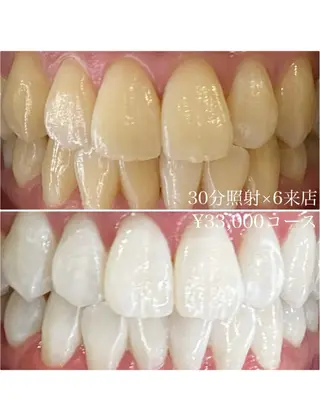 メンズ ホワイトニングルーム　川崎店所属・ホワイトニング ルーム　川崎店のその他イメージ