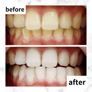 LBSホワイトニング 🌐渋谷店 河内のエステ・リラクイメージ