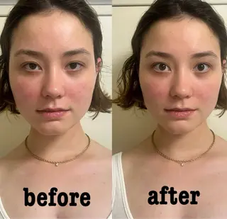 美容鍼灸サロン mahoroba院長のエステ・リラクイメージ