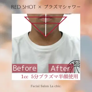 La chic.のエステ・リラクイメージ