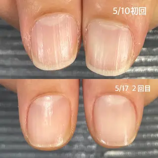 ネイル 奥園 良恵のネイルデザイン