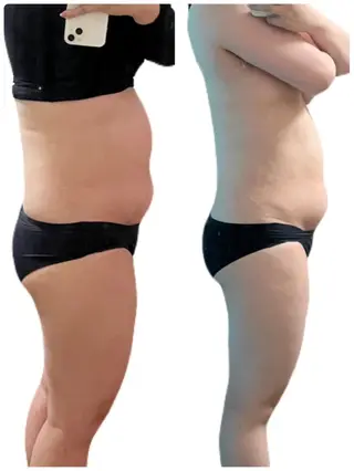 痩身サロン ベルタ 薬院店 濵畑のエステ・リラクイメージ