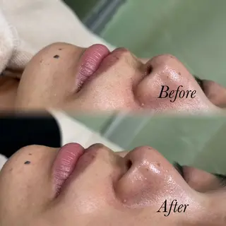 🫧美しい素肌へ🫧 今成柚乃のその他イメージ