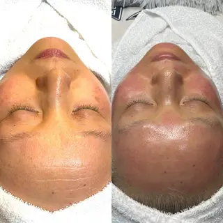 Honey Moom所属・Honey Moomのエステ・リラクイメージ