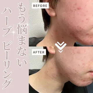 Liberte リベルテ(トモ化粧品店内)所属・RINA 🍒のマツエク・マツパデザイン