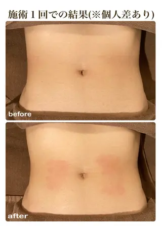 Refull（リフル）所属・Refull （リフル）のエステ・リラクイメージ