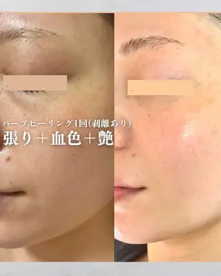 カムイ所属・カムイ 山﨑のエステ・リラクイメージ