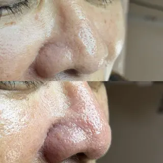 毛穴ケア・ヘッドスパサロンSHINY(シャイニー)所属・毛穴ケア・ヘッドスパ サロンSHINYのエステ・リラクイメージ