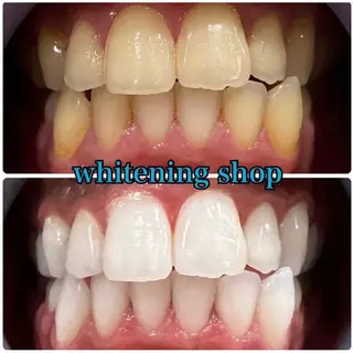 ホワイトニング ショップ吉祥寺店のエステ・リラクイメージ