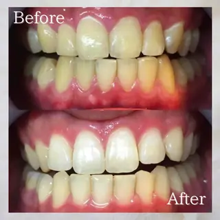 LBSホワイトニング 🌐岡山店のその他イメージ