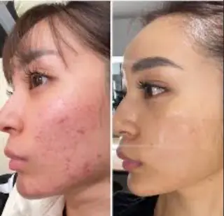 エステサロン ルーサ所属・和賀 ひろこのエステ・リラクイメージ